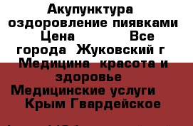 Акупунктура, оздоровление пиявками › Цена ­ 3 000 - Все города, Жуковский г. Медицина, красота и здоровье » Медицинские услуги   . Крым,Гвардейское